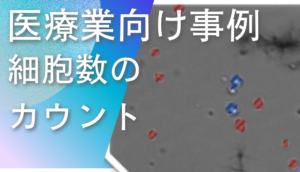 ディープラーニング画像解析ソフトNAITによる細胞数カウントの検査事例
